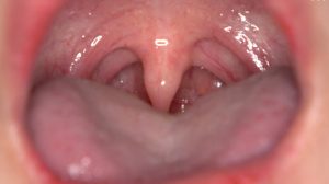 Thumbnail of post image 098